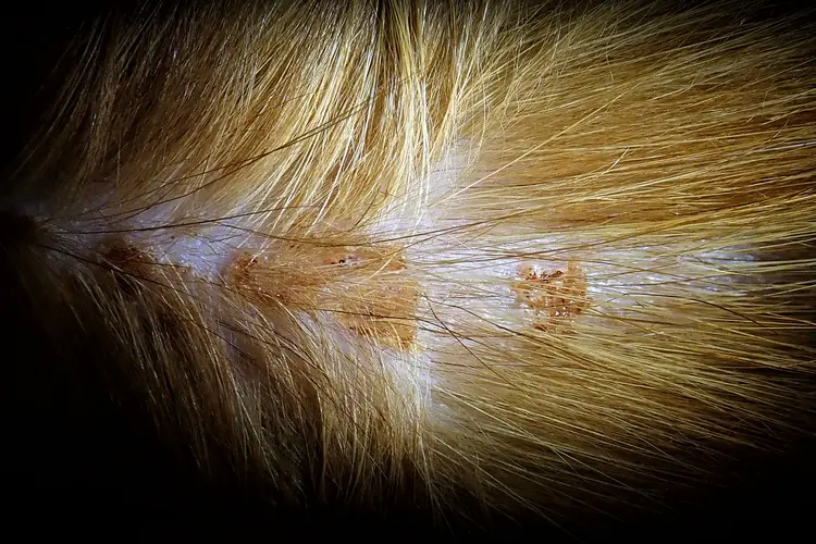 Skin Recovery Treatment